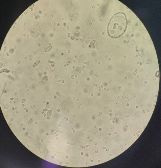 做的时候下面流白色粘稠物（做的时候会有白色液体流出来）